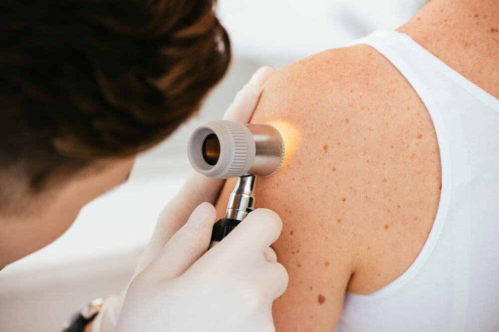 Medical Dermatology in jaipur