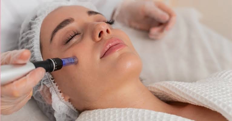 Microneedling in Jaipur