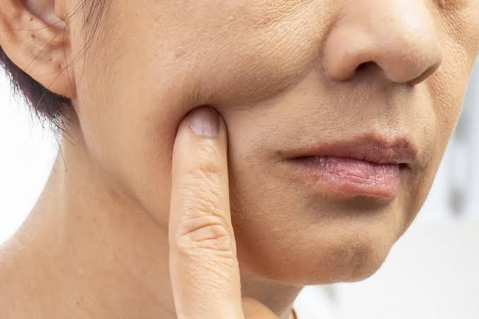 Sagging Skin Treatment in jaipur