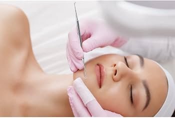 comedone extraction in jaipur
