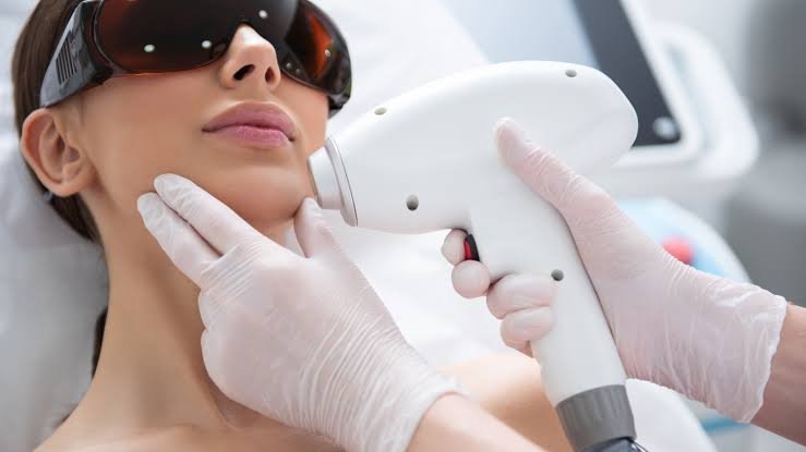 Laser Hair Removal treatment in jaipur