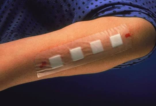 Patch Test in Jaipur